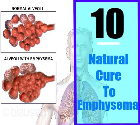 10 remède naturel à l'emphysème