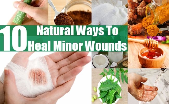10 façons naturelles Top pour guérir les blessures mineures