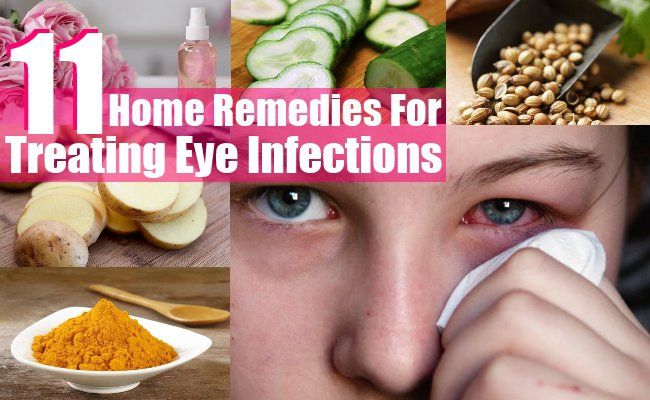 11 Accueil recours pour le traitement des infections de l'oeil