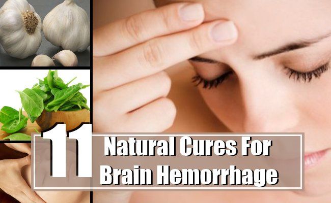 11 remèdes naturels les plus efficaces pour une hémorragie cérébrale
