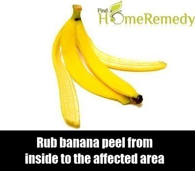 Pelure De Banane