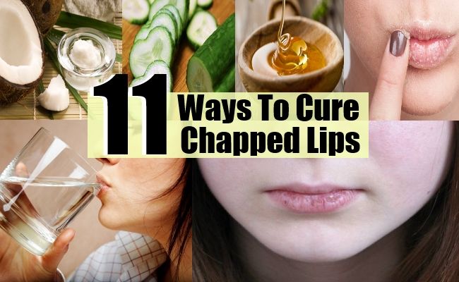 11 façons de guérir les lèvres gercées