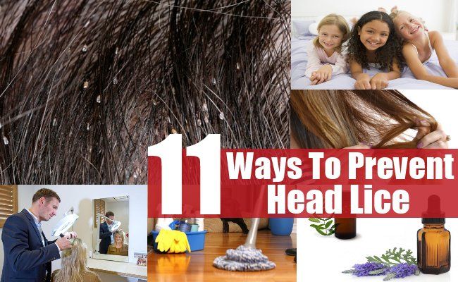 11 façons de prévenir les poux de tête