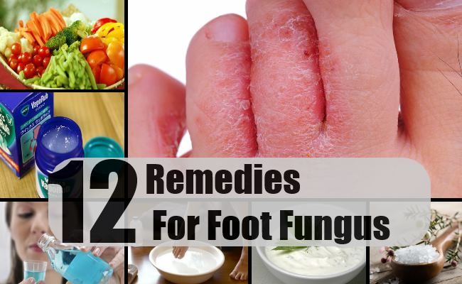 12 remèdes efficaces à domicile pour mycose des pieds