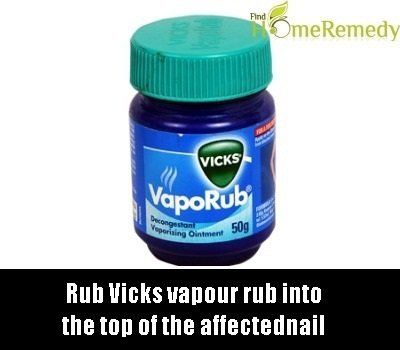 Vicks VapoRub