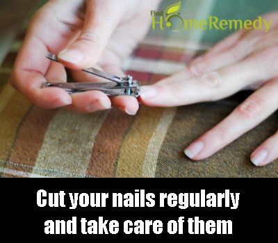 Coupez vos ongles