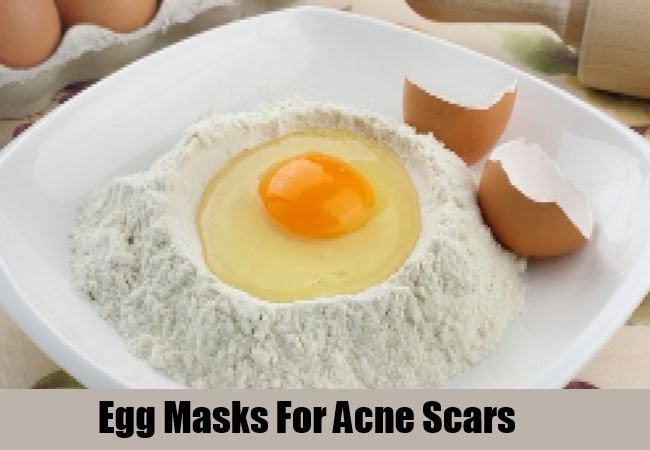 Egg Masques