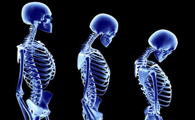Prévient l'ostéoporose