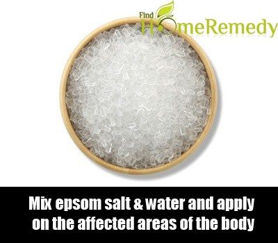 Le sel d'Epsom