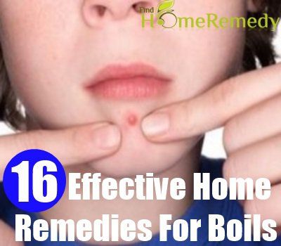 16 remèdes efficaces à domicile pour les furoncles