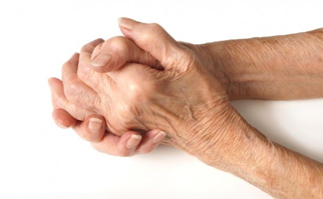 Gérer l'arthrite