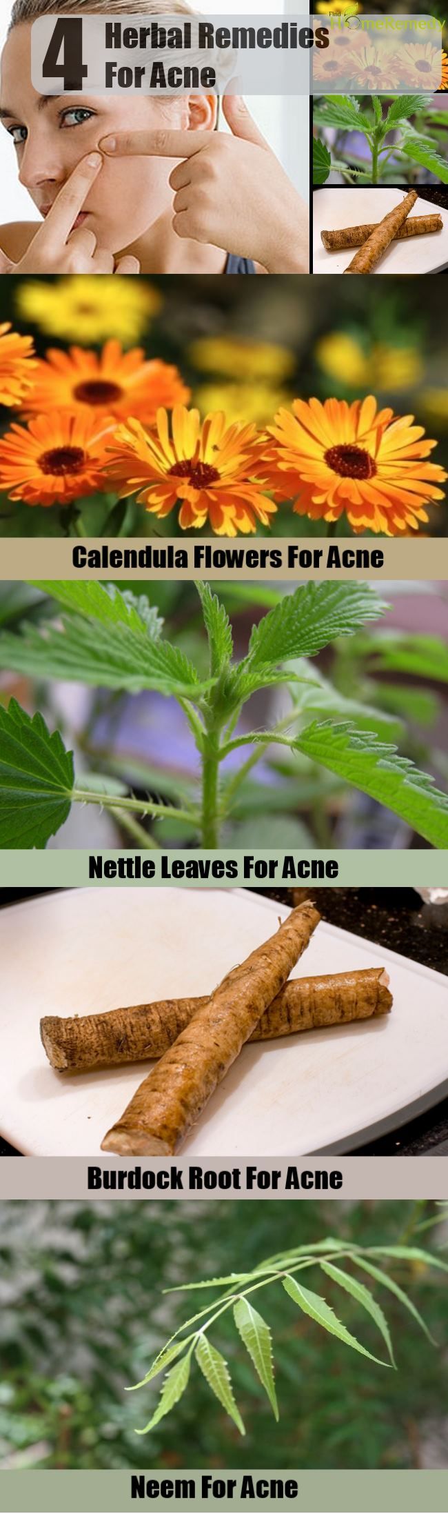 4 Remèdes naturels pour l'acné