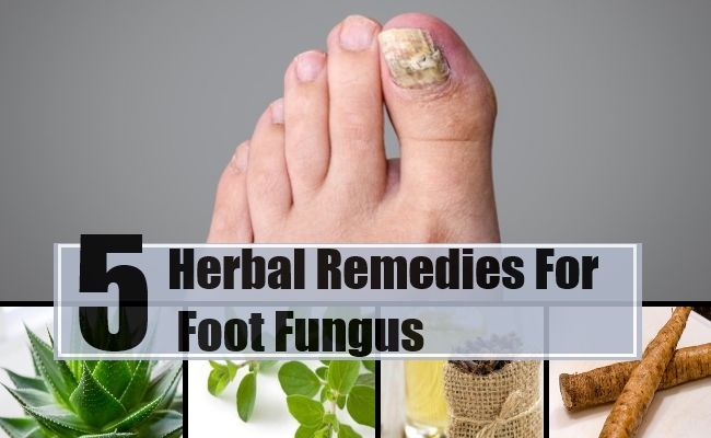 5 remèdes étonnants pour la mycose des pieds