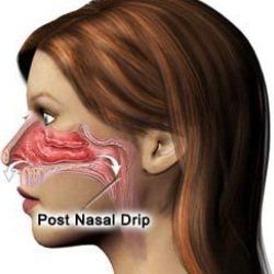 5 remèdes étonnants pour le post écoulement nasal