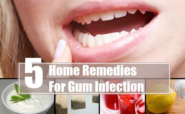 Gum Infection