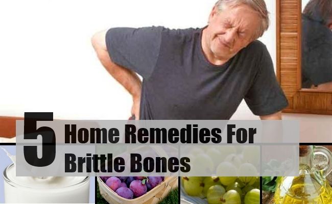 5 meilleurs remèdes maison pour les os fragiles