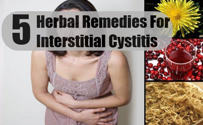 5 remèdes efficaces pour la cystite interstitielle