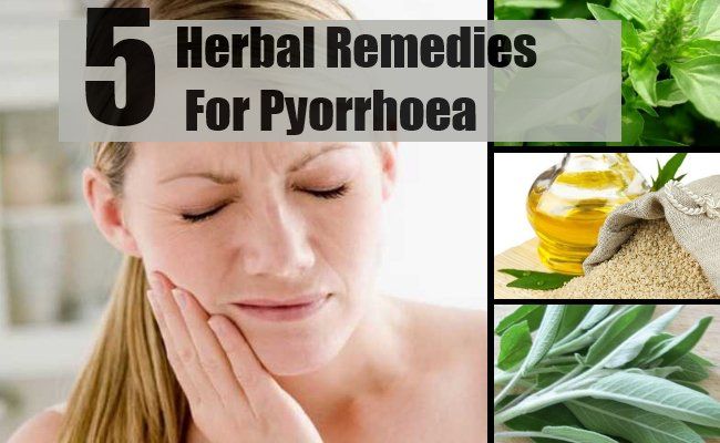 5 remèdes à base de plantes pour pyorrhée