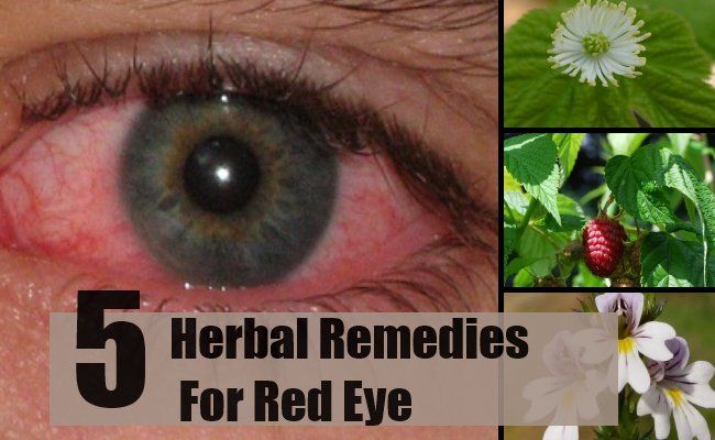 5 remèdes à base de plantes pour les yeux rouges