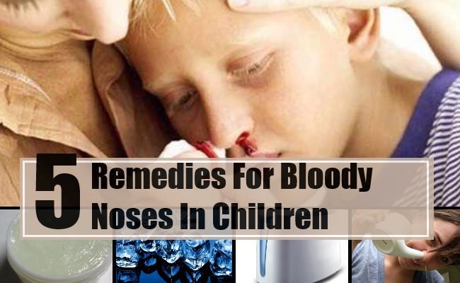 5 Accueil recours pour les saignements de nez chez les enfants