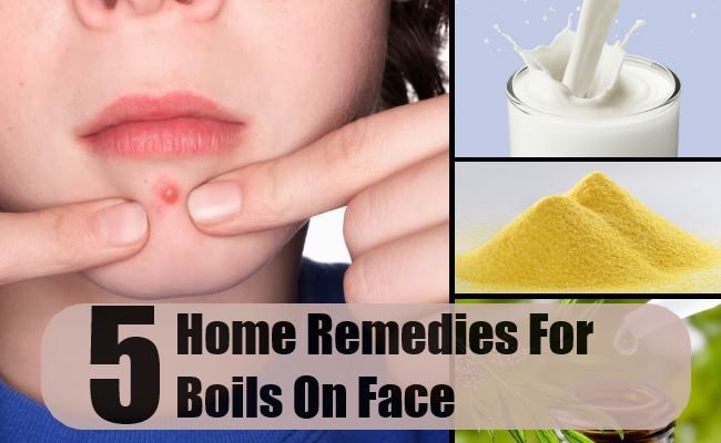5 remèdes maison pour les furoncles sur le visage