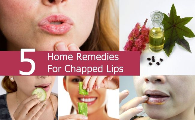 Remèdes à la maison pour les lèvres gercées