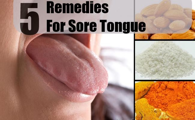 Remèdes pour Tongue Sore