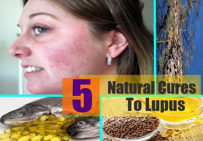 5 remèdes naturels à lupus