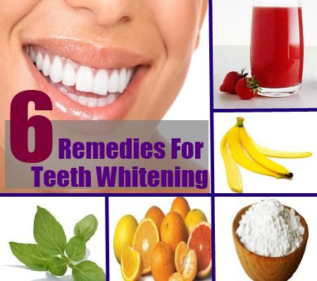5 Traitements naturels pour le blanchiment des dents