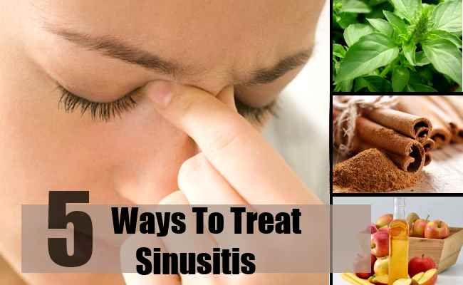 5 façons de traiter la sinusite