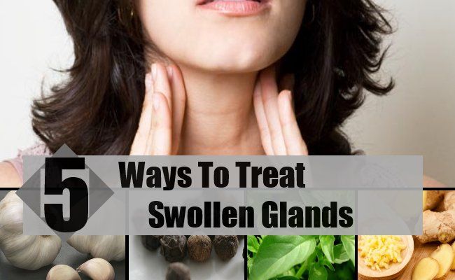 5 façons de traiter des glandes enflées