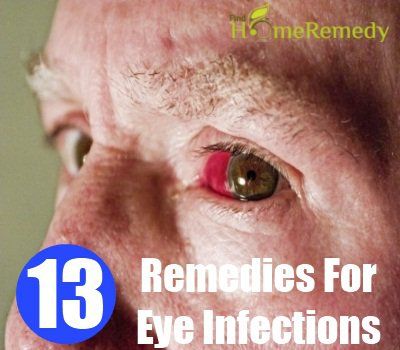 6 remèdes étonnants pour les infections oculaires