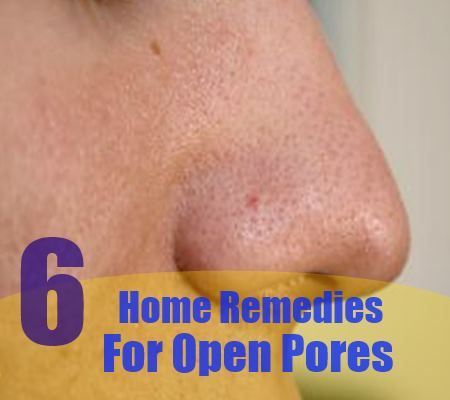 6 remèdes maison pores ouverts