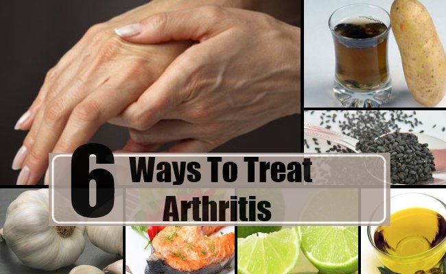 6 moyens efficaces pour traiter l'arthrite