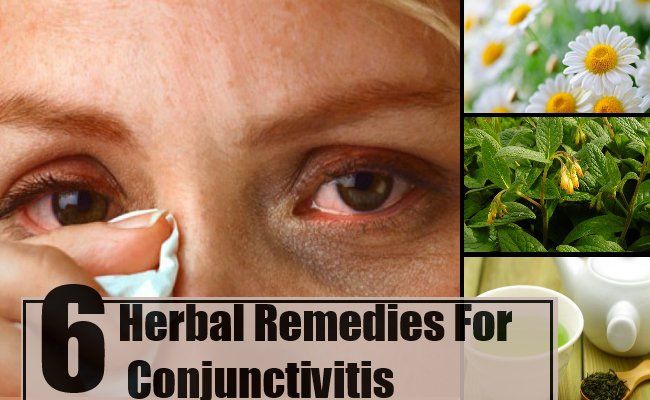 6 remèdes à base de plantes pour la conjonctivite