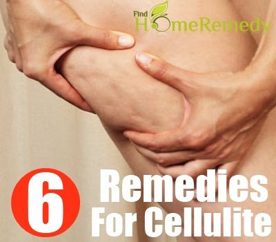6 remèdes maison simples pour la cellulite