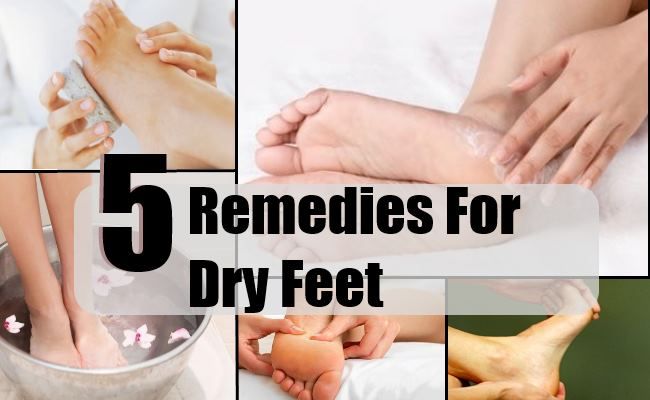 6 remèdes maison simples pour les pieds secs