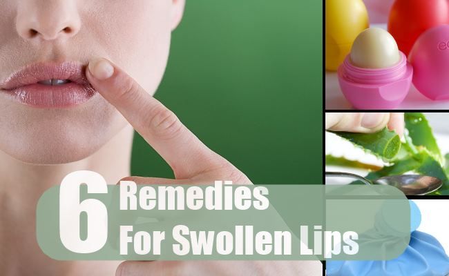 Remèdes pour les lèvres enflées
