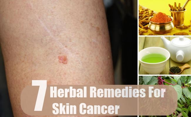7 remèdes étonnants pour le cancer de la peau