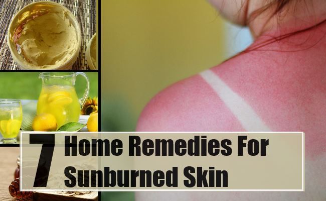 7 remèdes efficaces à domicile pour la peau brûlée par le soleil