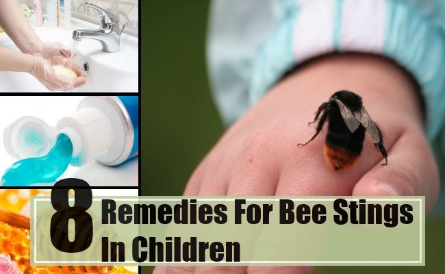 8 remèdes efficaces à domicile pour les piqûres d'abeilles chez les enfants