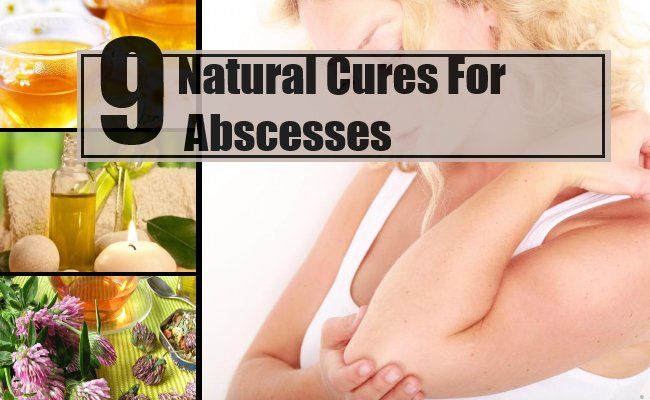 9 remèdes naturels efficaces pour les abcès