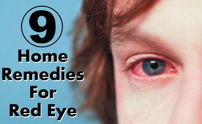 Remèdes maison pour Red Eye