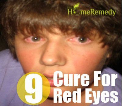 9 remède naturel pour les yeux rouges