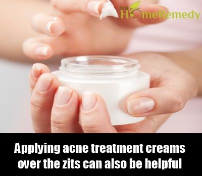 crèmes de traitement de l'acné
