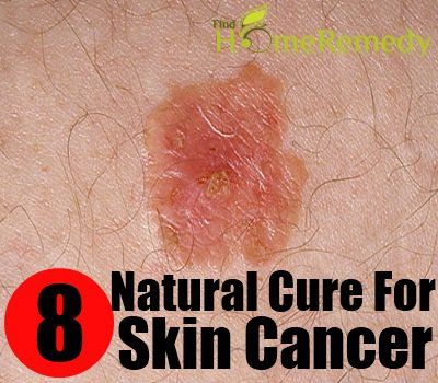 8 remède naturel pour le cancer de la peau