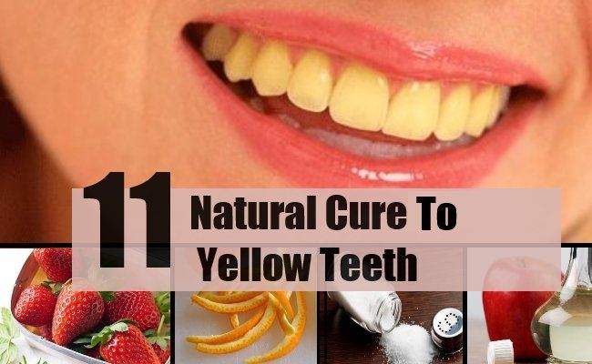 Top 11 des remèdes naturels pour les dents jaunes