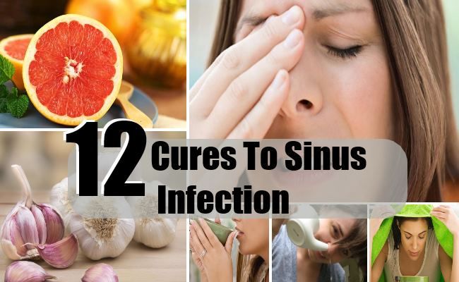 12 Cures à l'infection des sinus