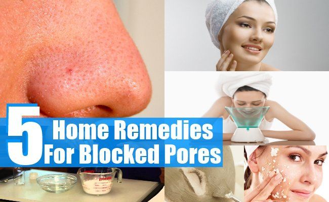 Top 5 des remèdes maison pour les pores obstrués