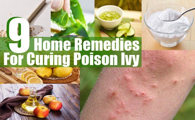 Top 9 des remèdes maison pour guérir poison ivy